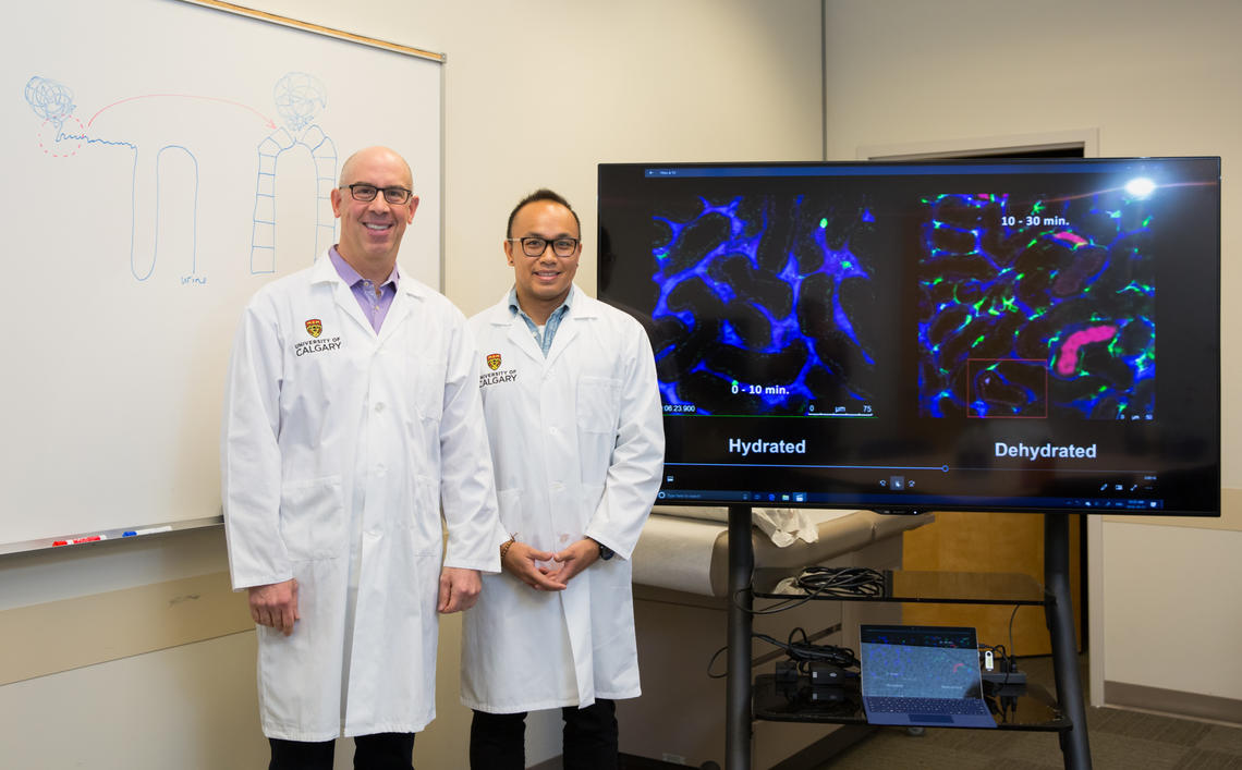 Dan Muruve, left, and his team, including postdoctoral fellow Arthur Lau, have discovered why contrast dyes in diagnostic tests can cause harm to kidneys.