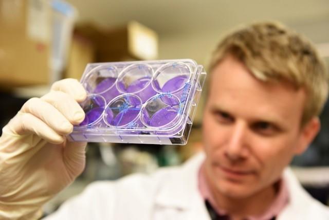 “We’ve been looking at these cancer drugs the wrong way — as tumour-targeting drugs — instead of what we now feel is their most important biological role: as immune stimulating therapy,” says University of Calgary researcher and the study's principal investigator Doug Mahoney. Photos provided by Doug Mahoney’s Lab