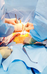 cardiac surgeons