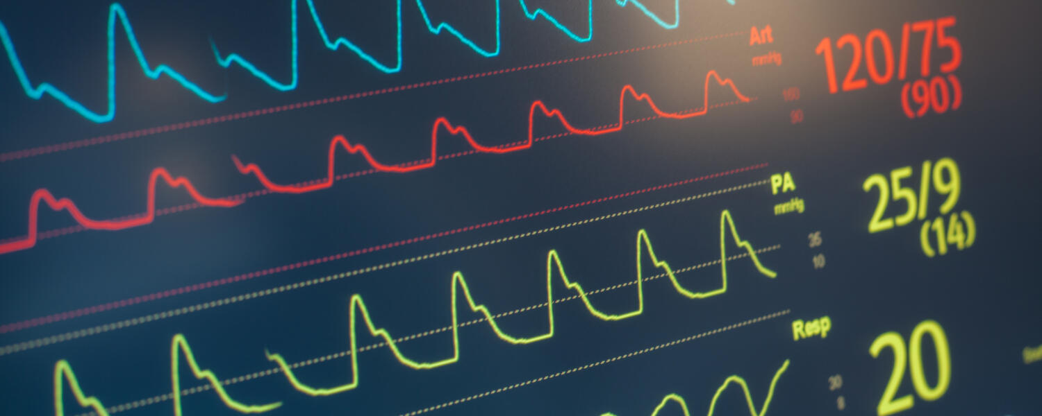 Image of a ECG machine