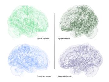 Brains develop in many shapes and sizes