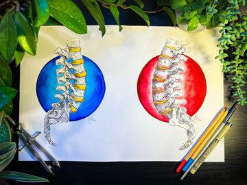 Drawing a Better Understanding of Adult Spinal Deformities and Surgical Consent